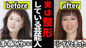 【ガルちゃん芸能】実は整形している芸能人!視聴者にバレバレw【有益2ch】