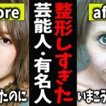 【ガルちゃん芸能】整形しすぎた芸能人・有名人【有益2ch】