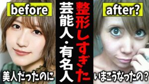 【ガルちゃん芸能】整形しすぎた芸能人・有名人【有益2ch】
