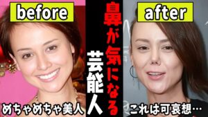 え、整形？元から！？鼻がどうしても気になる芸能人…【ガルちゃん芸能・有益2ch】