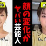【ガルちゃん芸能】これはさすがに...顔の変化がヤバい芸能人【有益2ch】