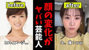 【ガルちゃん芸能】これはさすがに...顔の変化がヤバい芸能人【有益2ch】