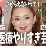 【ガルちゃん芸能】美容医療やりすぎ芸能人・有名人【有益2ch】