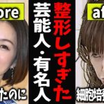 【ガルちゃん芸能】整形しすぎた芸能人・有名人【有益2ch】