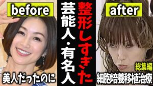 【ガルちゃん芸能】整形しすぎた芸能人・有名人【有益2ch】